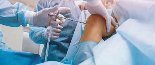 ARTHROSCOPY